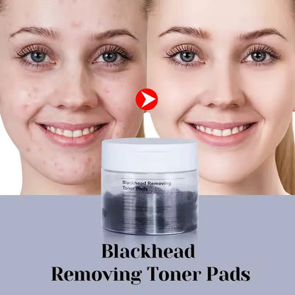 OEM Lactic Acid Blackhead Removal Pads | Panthenol Calming | Little Cotton Little Cotton